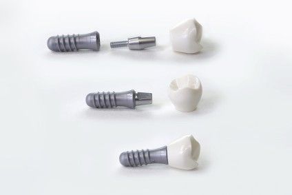 Zahnarztpraxis Dr. Mesut Cosgun - Leistungen Implantate
