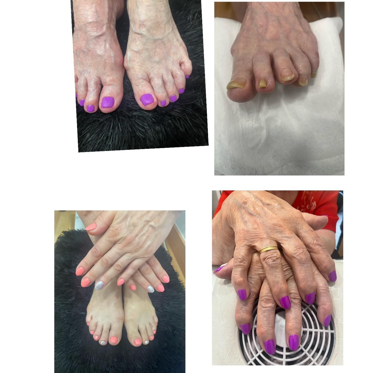 Un collage de cuatro fotografías de pies y manos de una mujer con uñas moradas.