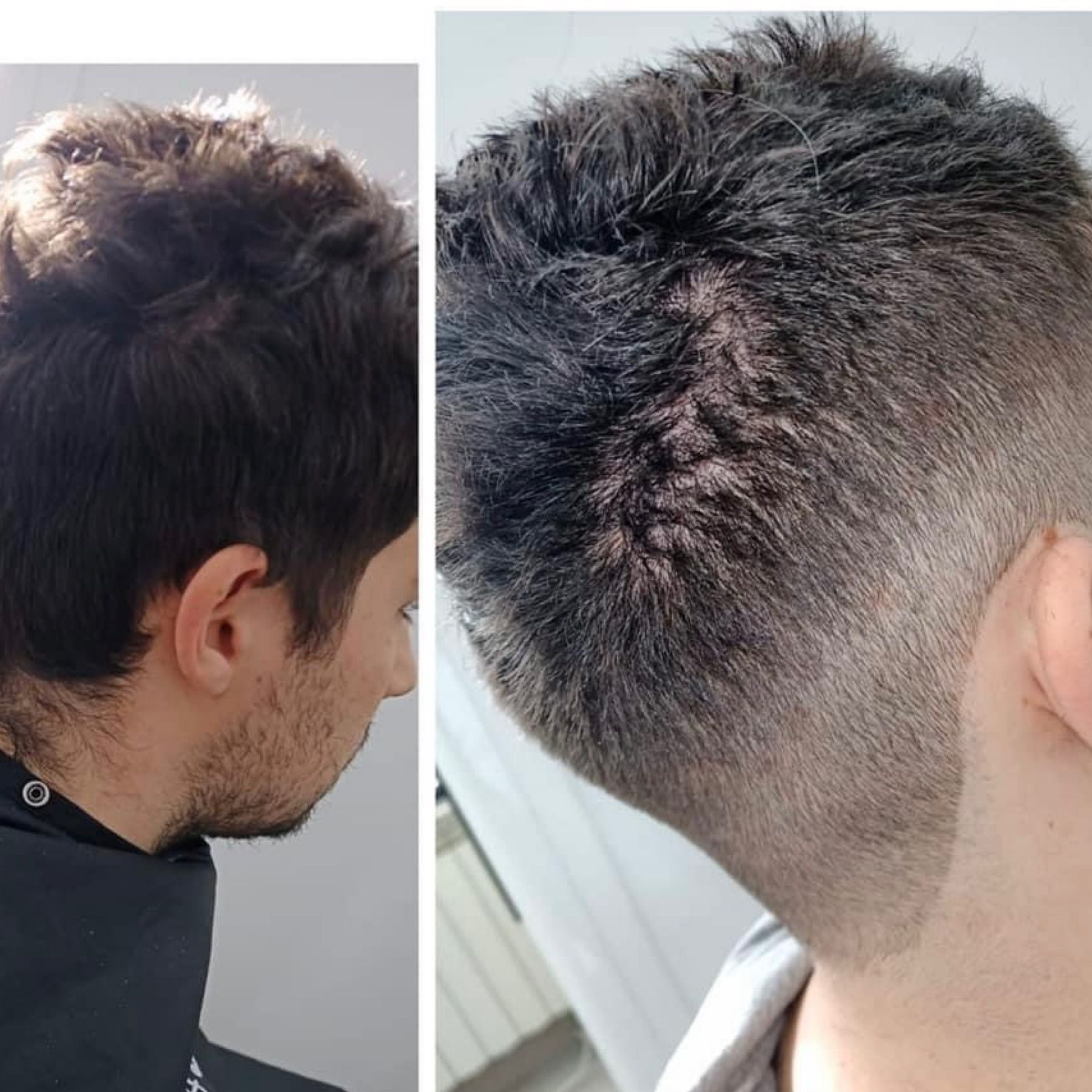 Dos fotografías del cabello de un hombre antes y después de un corte de pelo.