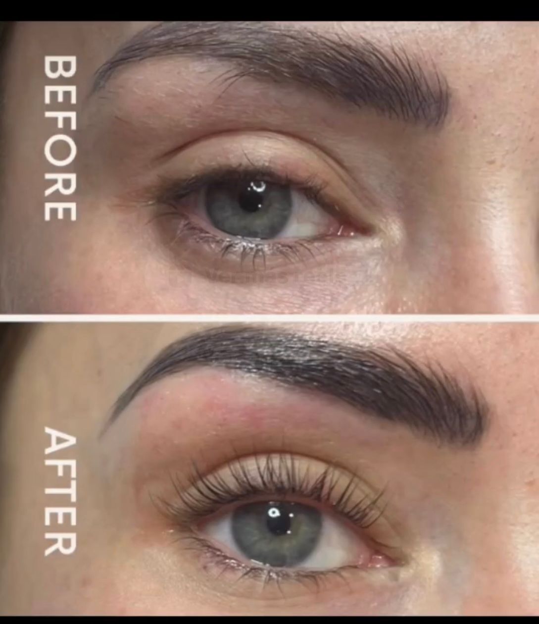 Una foto de antes y después de las cejas de una mujer.