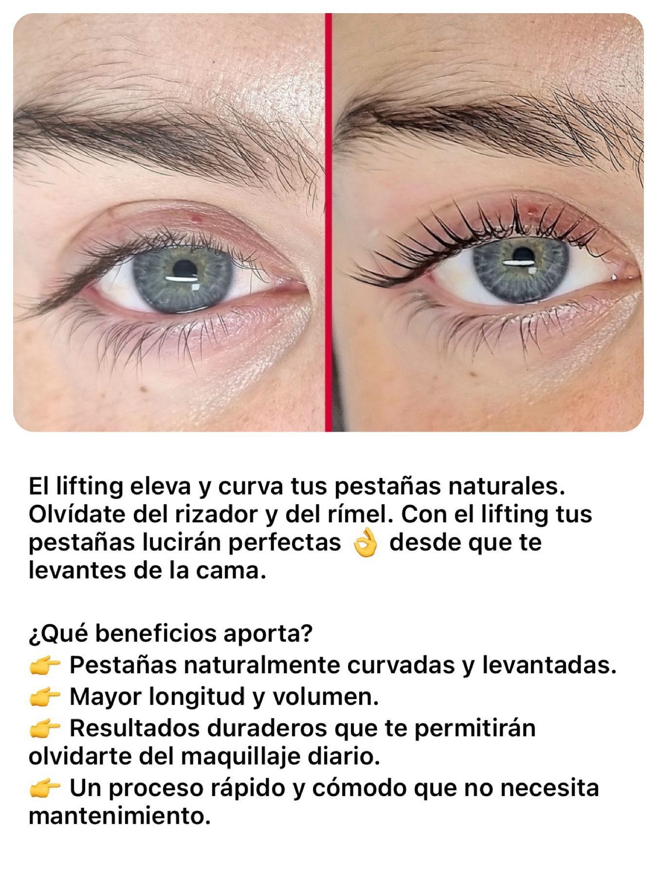 Una fotografía de antes y después del ojo de una mujer con una leyenda en español.