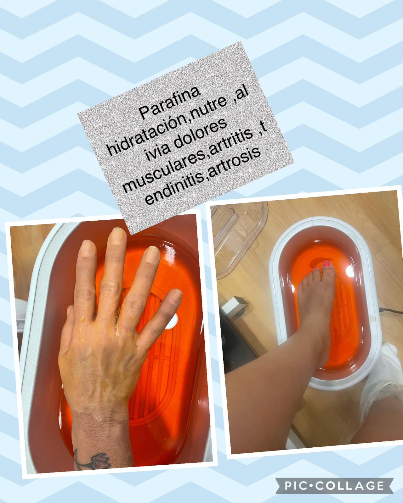 La mano y el pie de una mujer están siendo tratados con parafina.