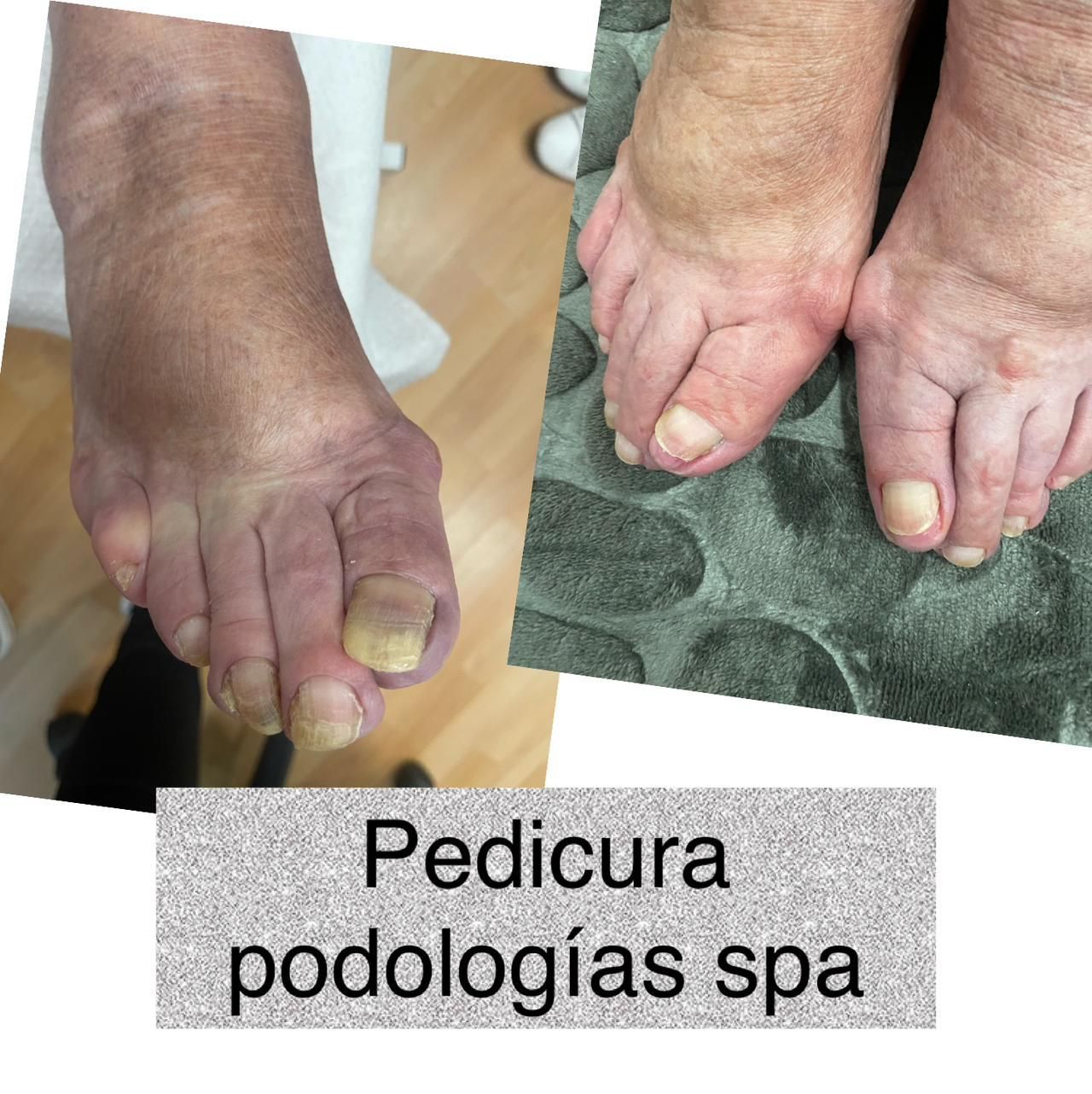 Una foto de los pies de una persona y las palabras pedicura podologias spa
