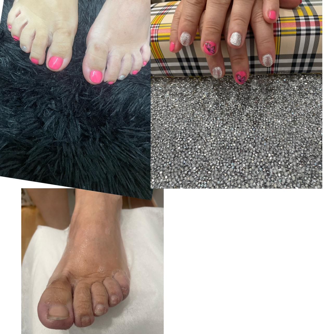Un collage de tres fotografías de pies y uñas de una mujer.