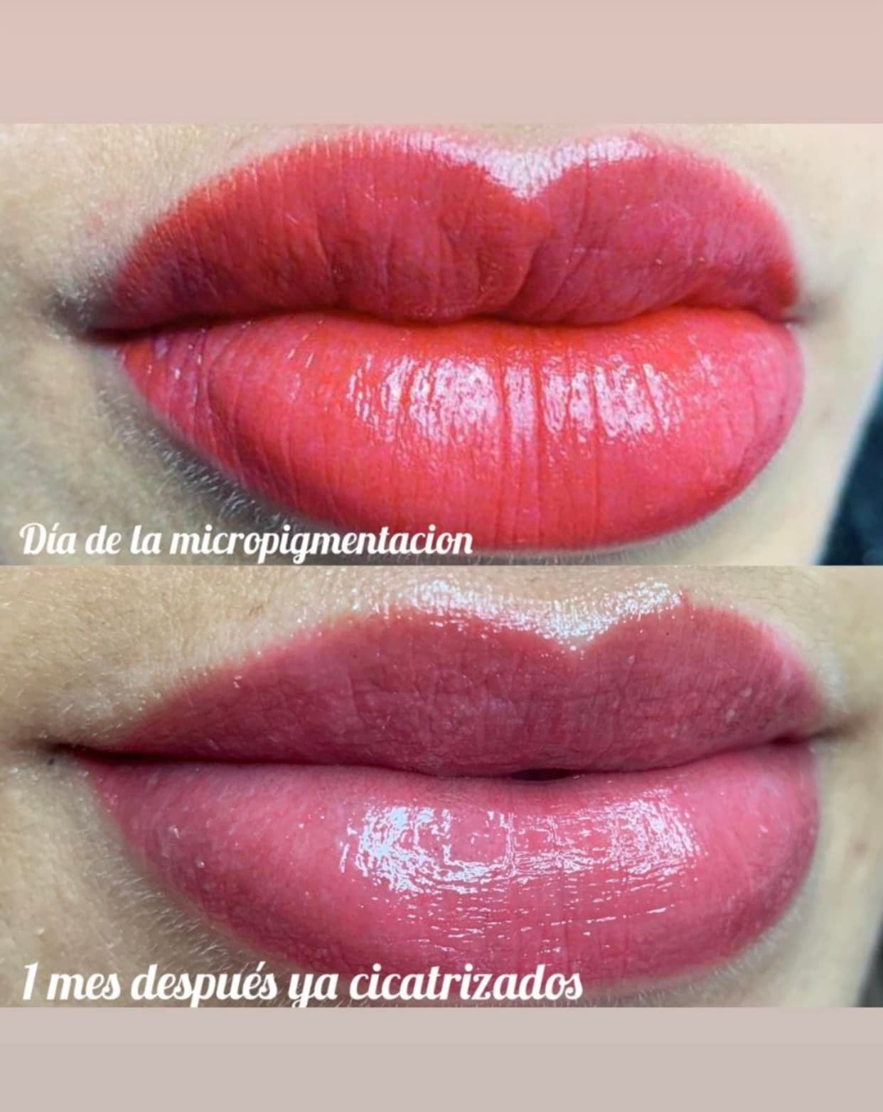 Arriba: Labios con micropigmentación rosa-rojiza. Abajo: Labios cicatrizados, un mes después, rosados con brillo.