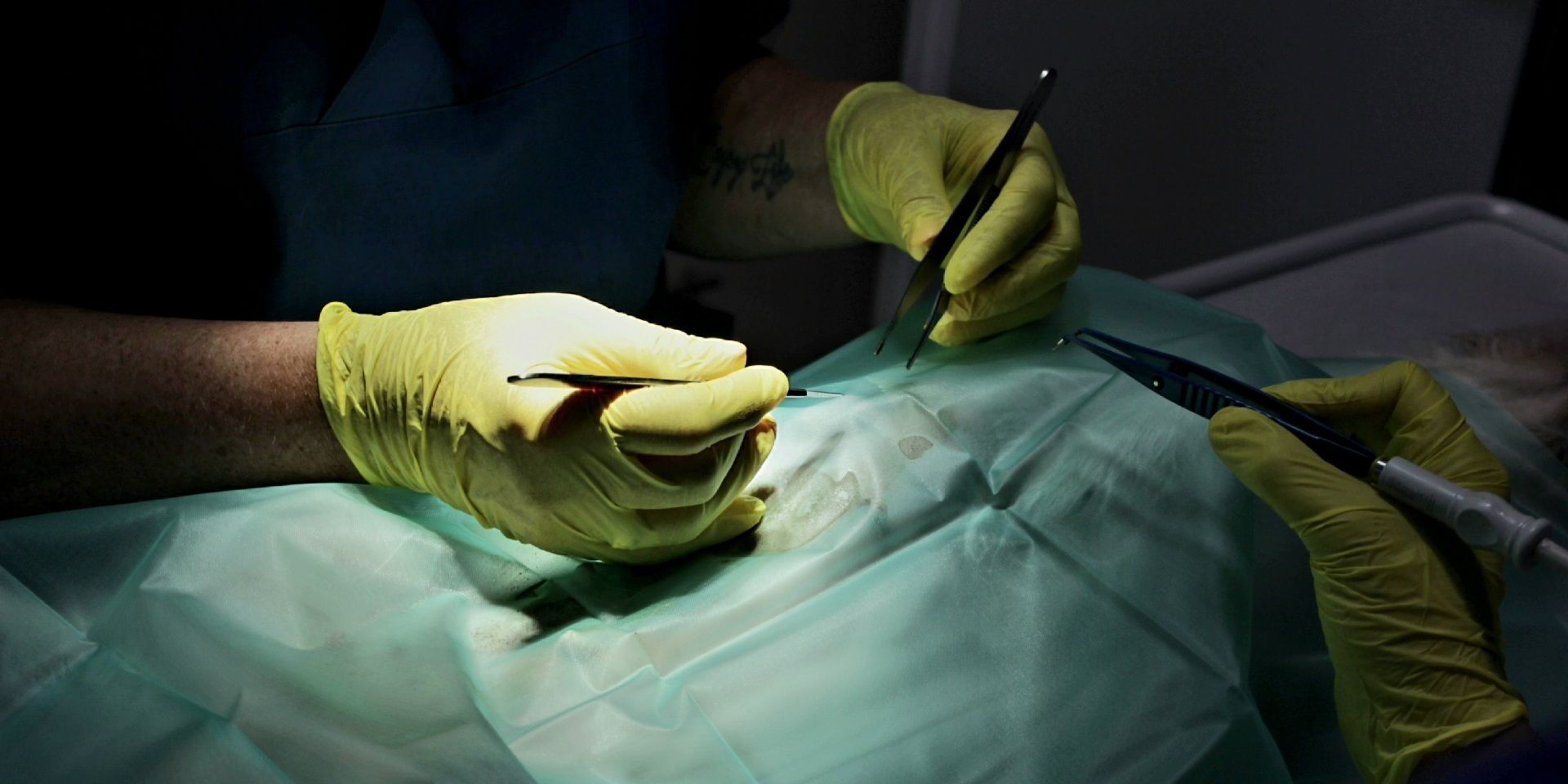 Operation