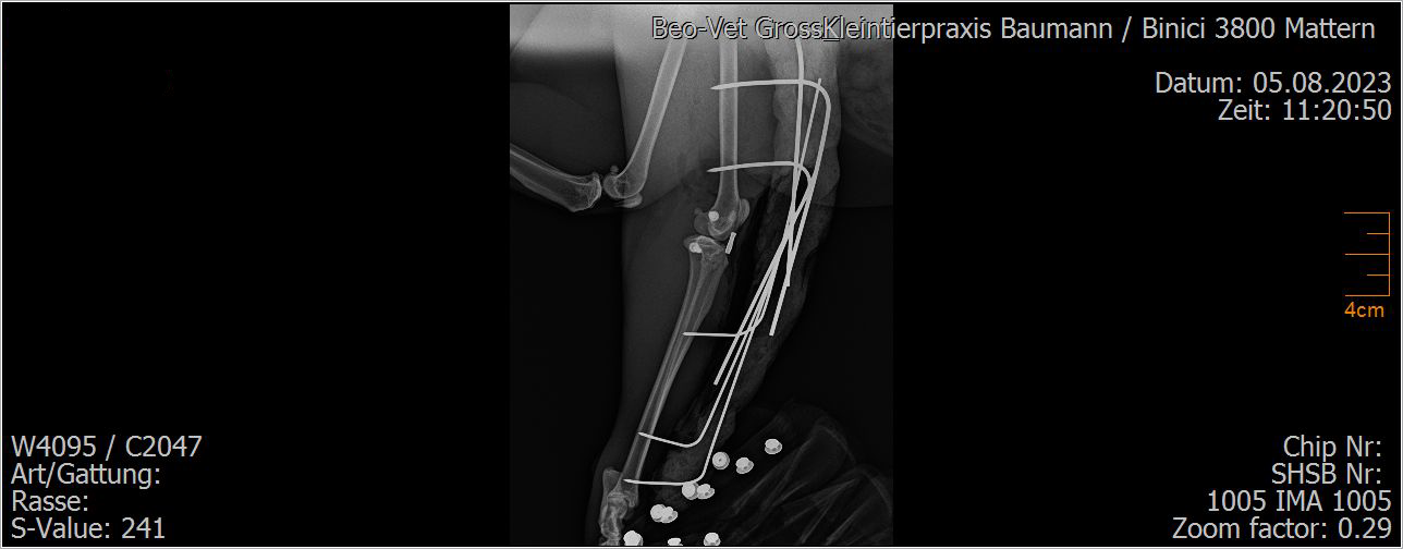 Ein Schwarzweißbild des Arms einer Person mit einer Leiter darauf.
