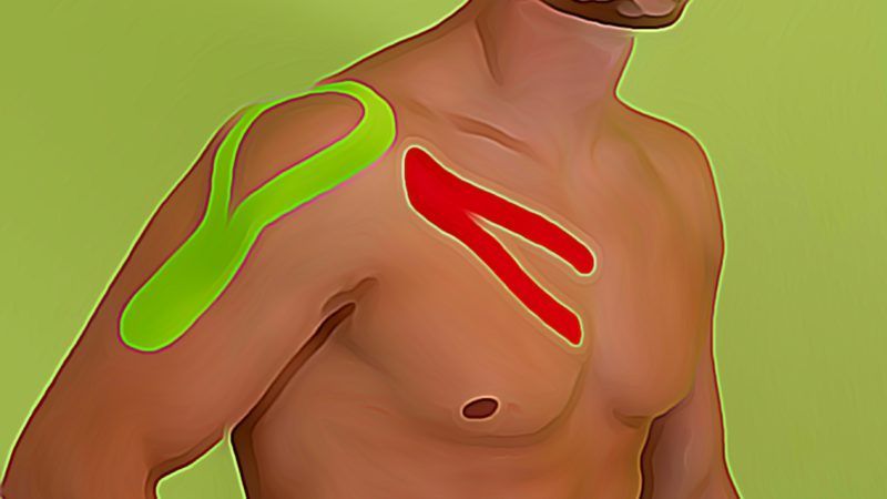 Ein Mann ohne Hemd mit grünem und rotem Kinesio-Tape auf der Schulter.