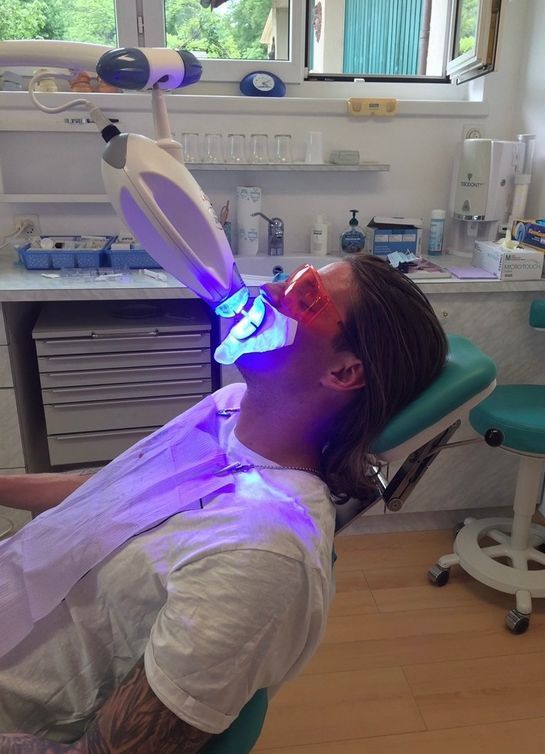 Mann bei einem Zahn-Bleaching in der Praxis