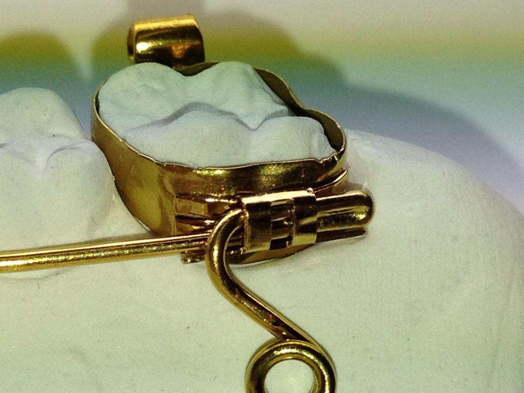 Spezialbeschichtung Quad-Helix