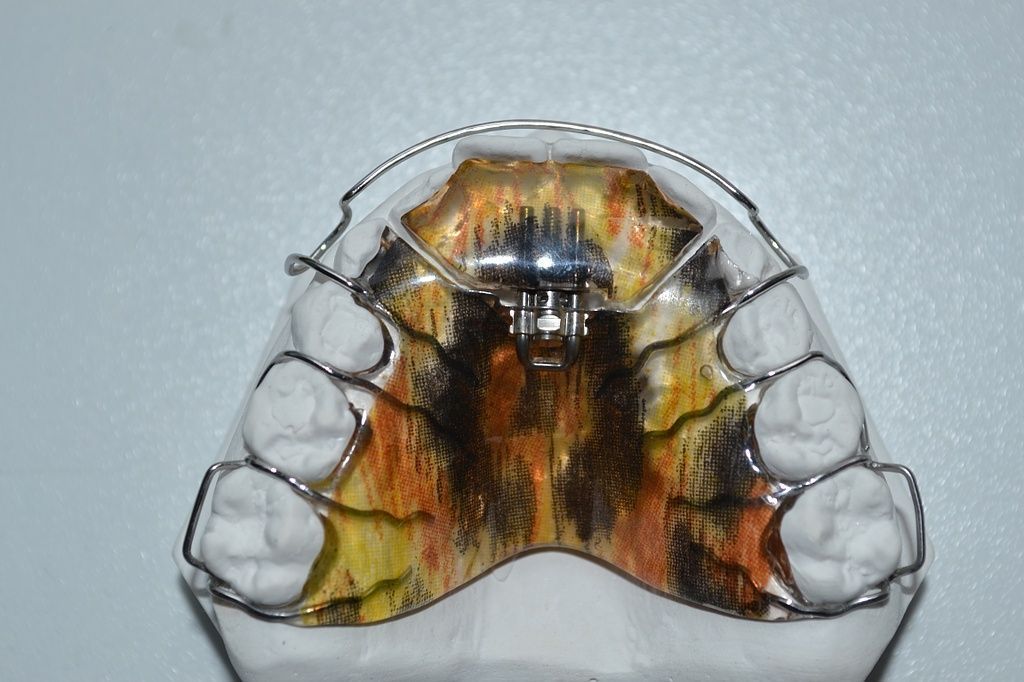 Coole designspangen von Dental Design Ilg in Basel