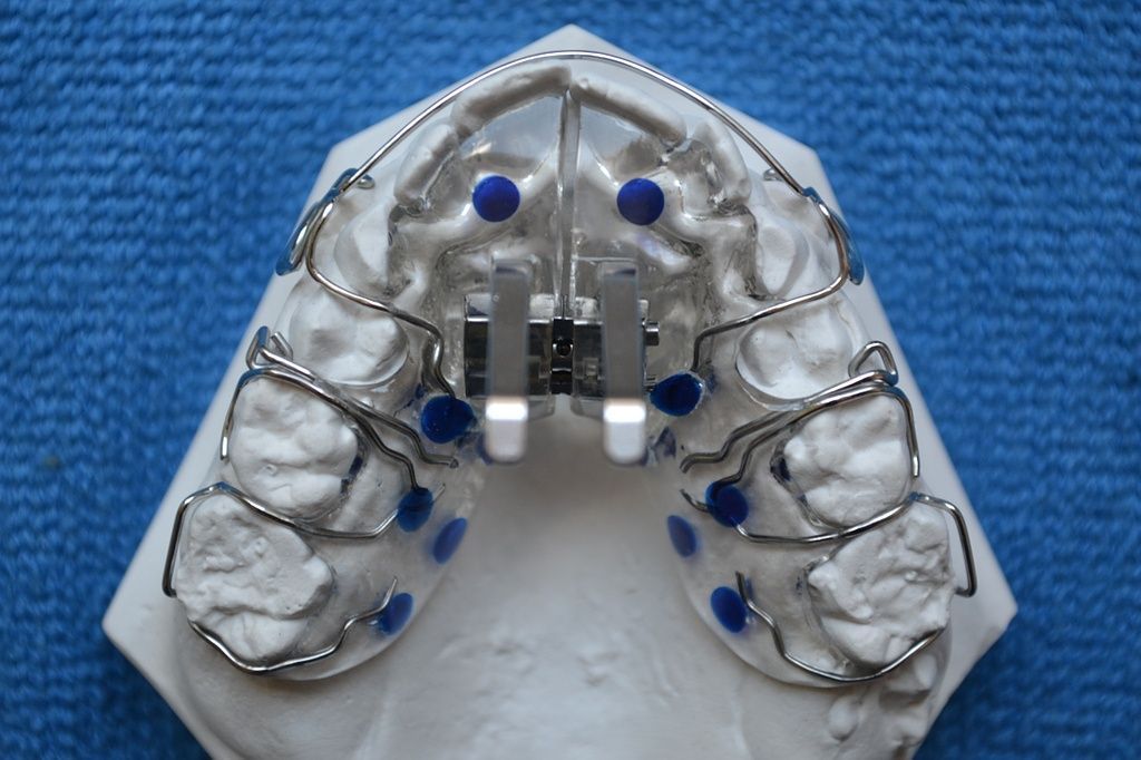 Coole Designspangen von Dental Design Ilg in Basel