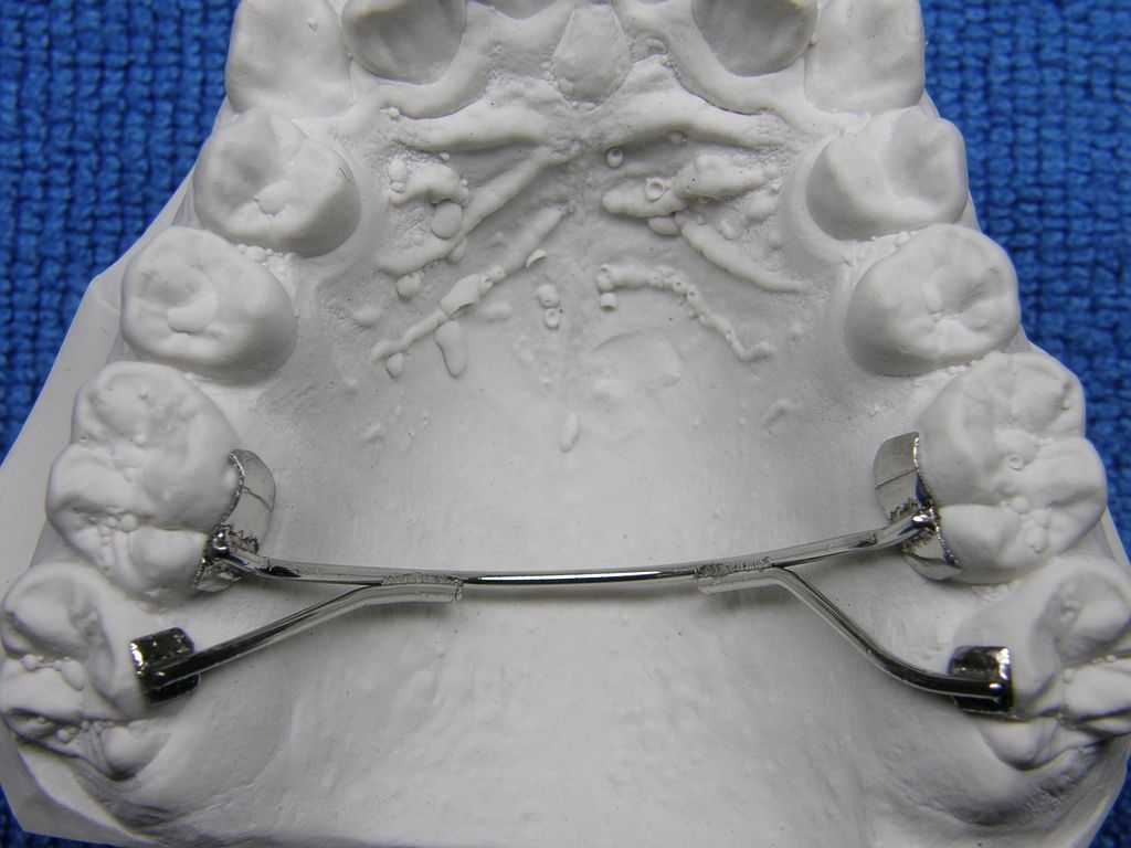 Doppel-Gosh mit Netzbasen