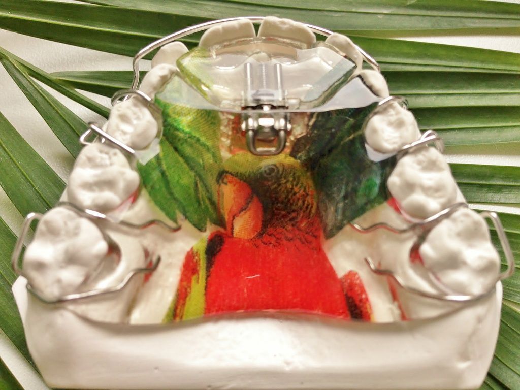 Coole Designspangen von Dental Design Ilg in Basel