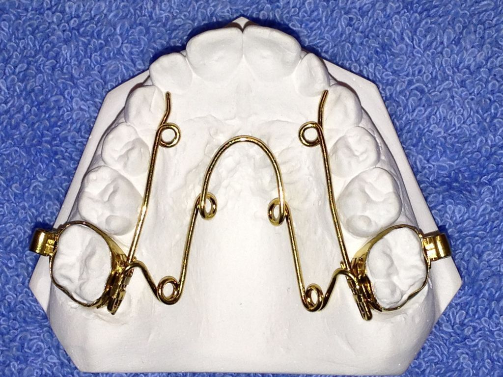 Spezialbeschichtung Quad-Helix