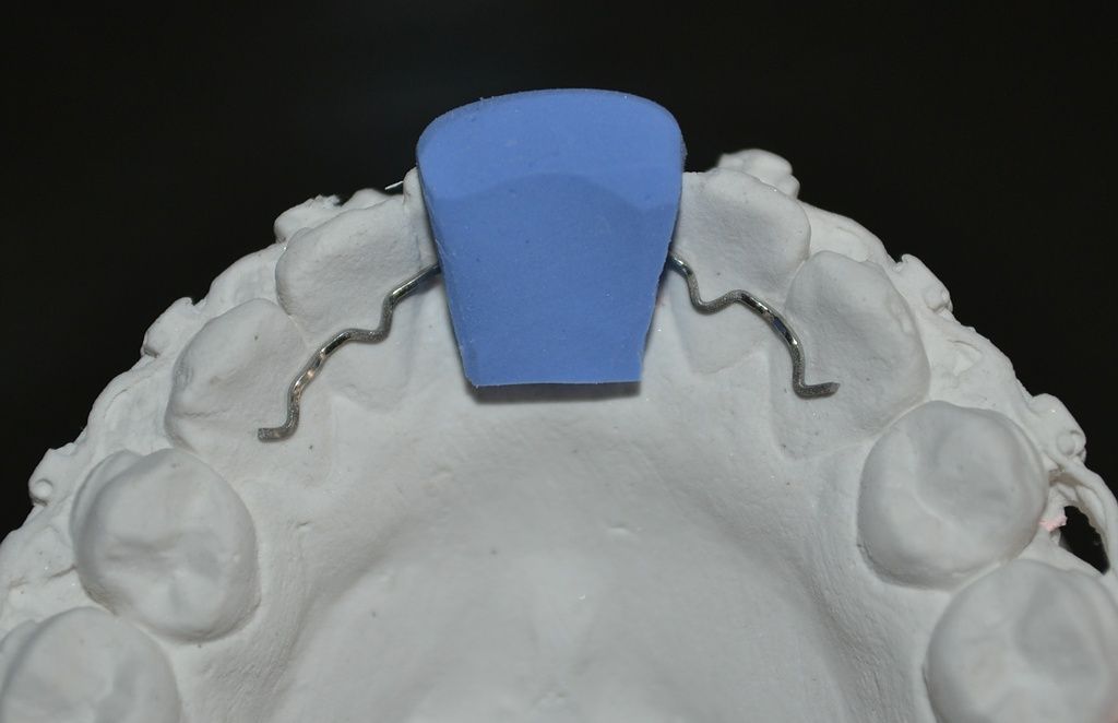 Retainer mit Positionshilfe Silikon