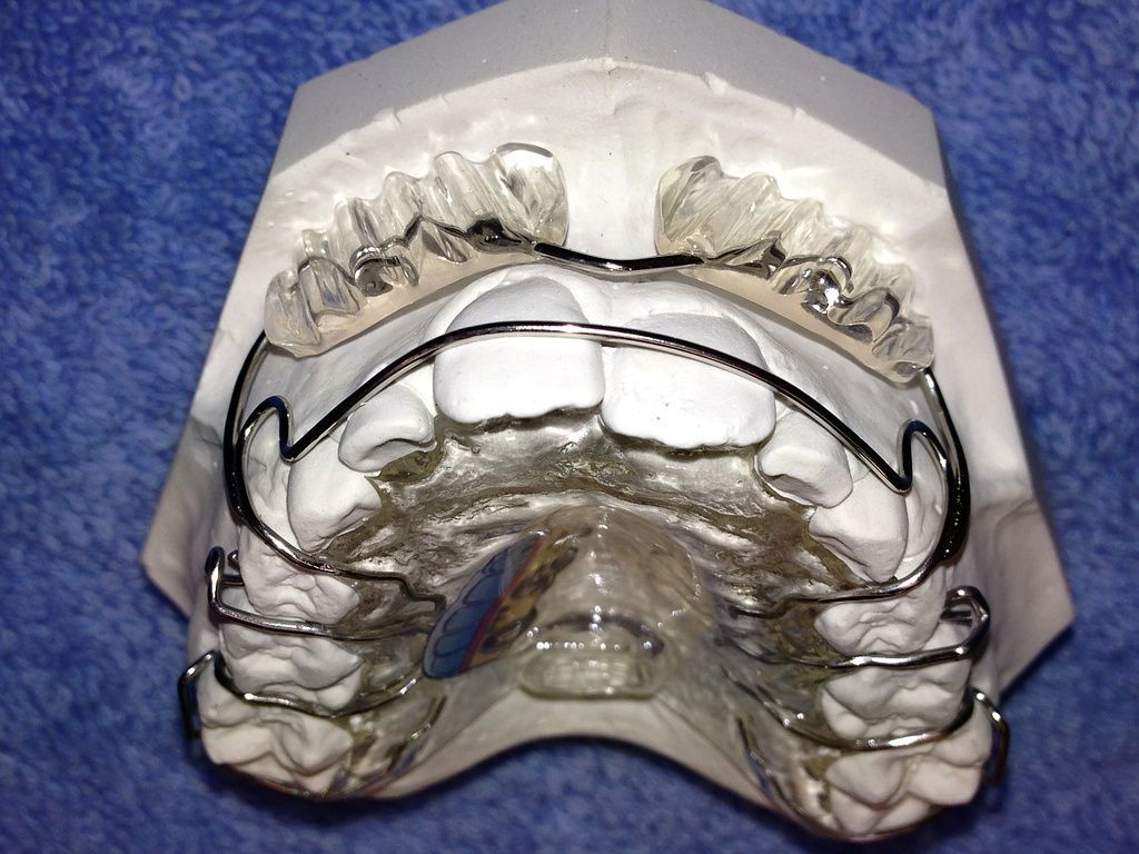 Castillo Morales Platte