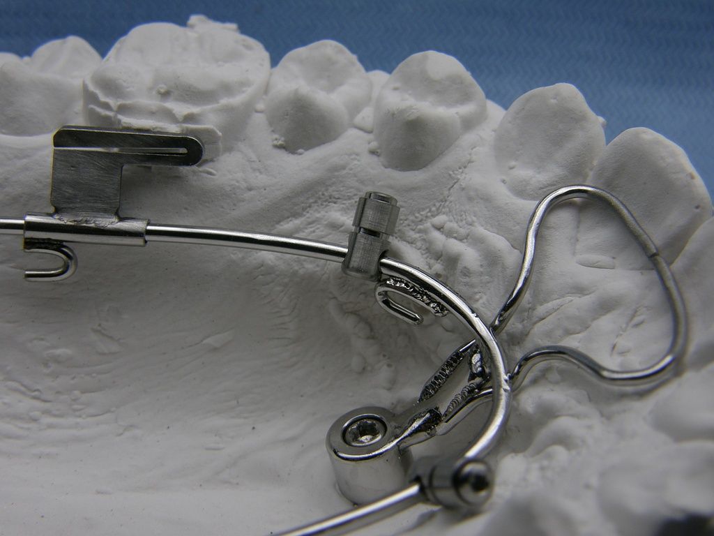 Benefit Mesial-Slider