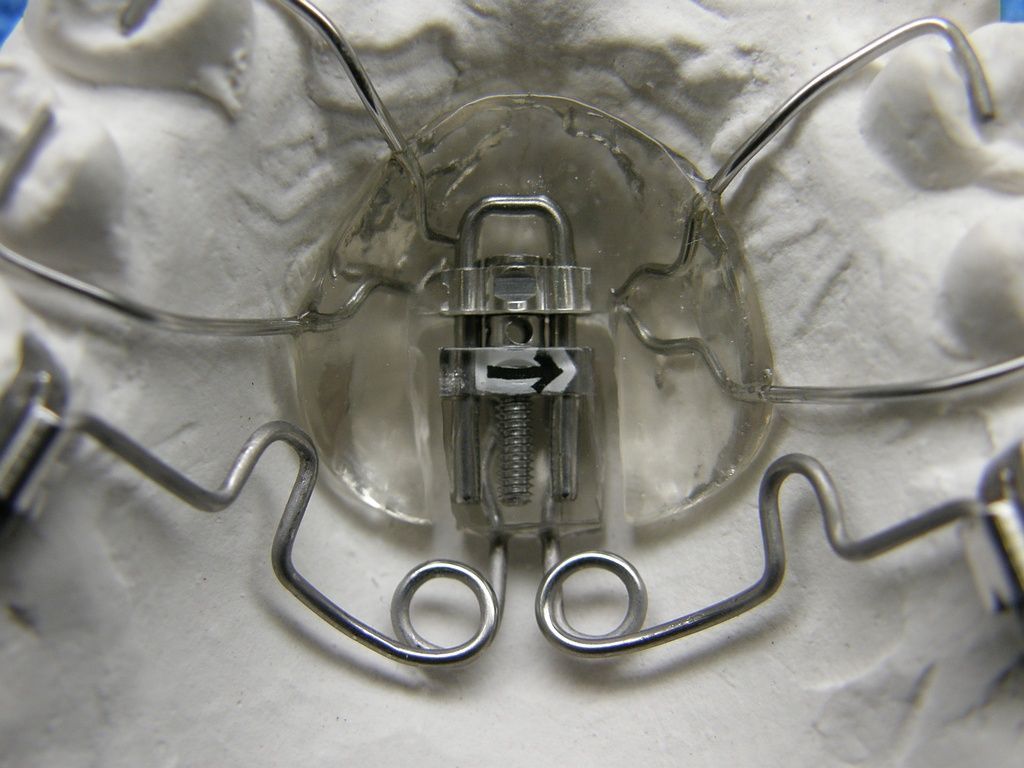 Pendulum mit distal.Schraube