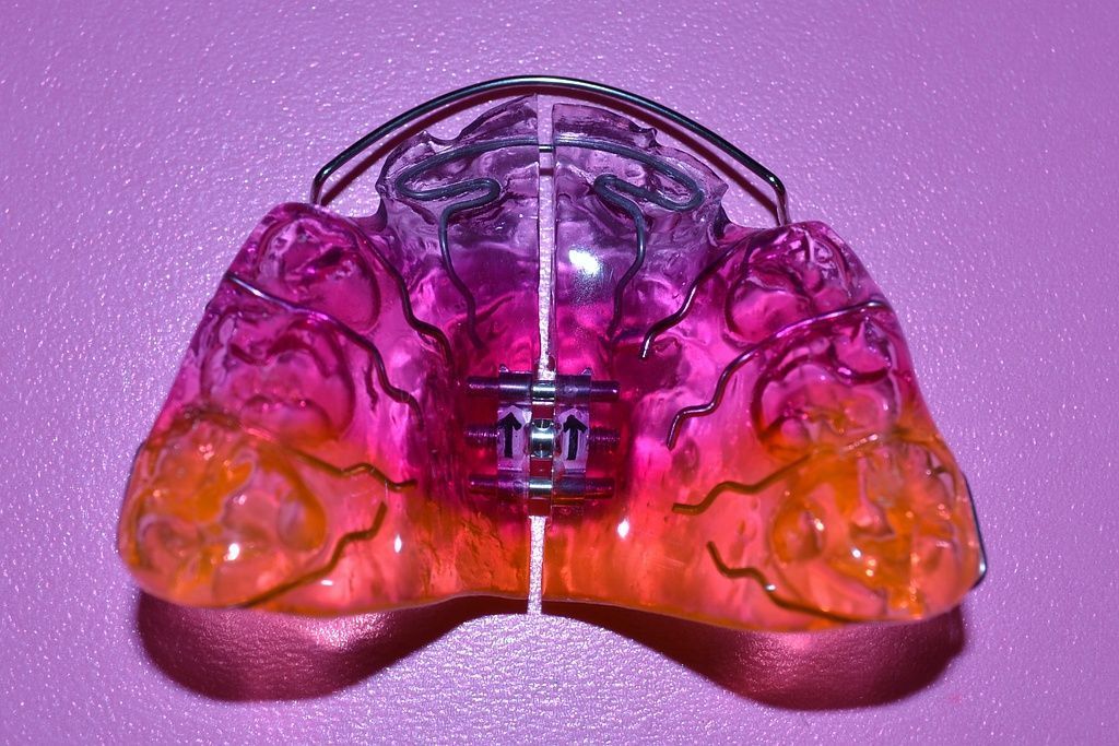 Coole Designspange von Dental Design Ilg in Basel