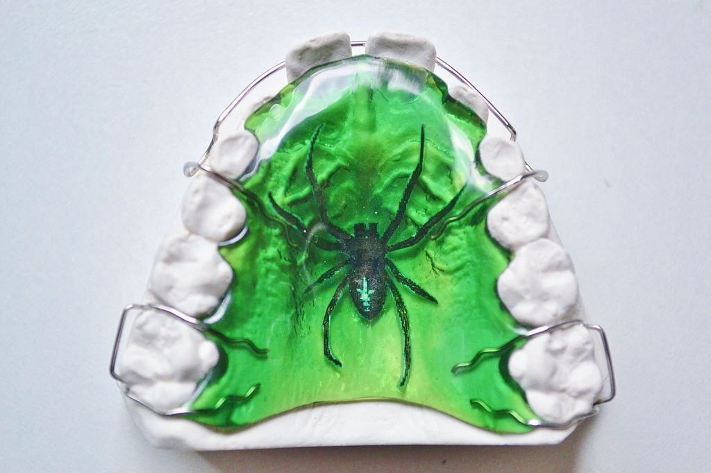 Coole Designspange von Dental Design Ilg in Basel