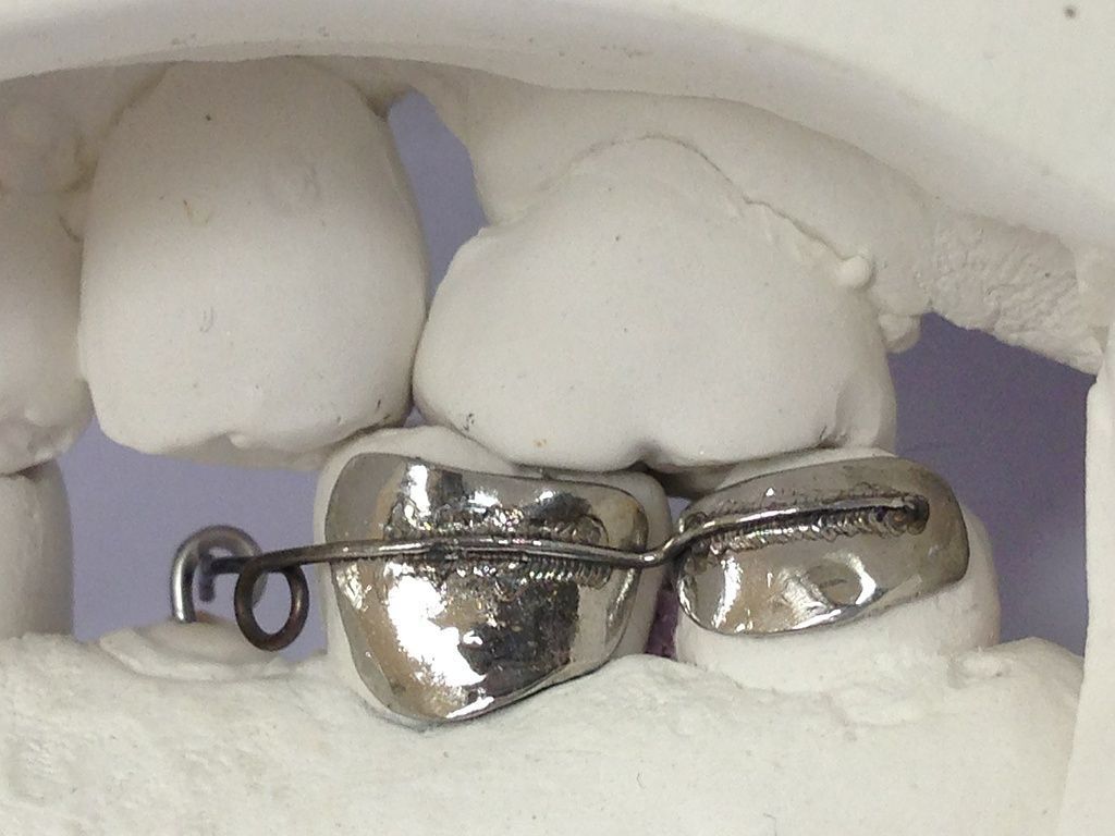 Netzbasen mit Extrusionsfeder nach Ilg