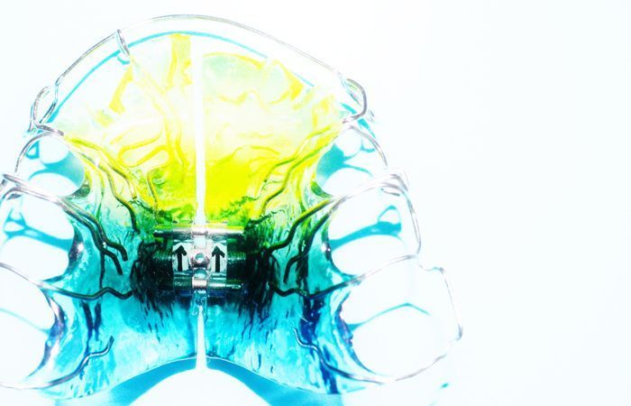 Coole Designspangen von Dental Design Ilg in Basel