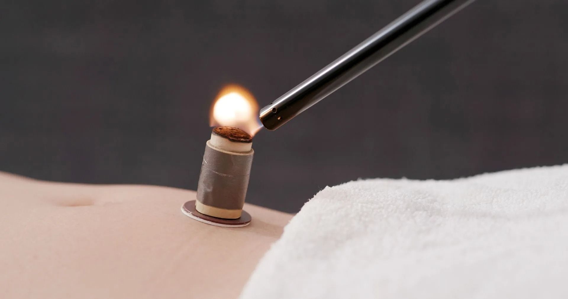 Ein beleuchteter Schröpfkopf auf der Haut neben einem weissen Handtuch, darüber eine Metallzange.