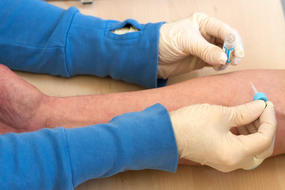 Professionelle Lungenbehandlung