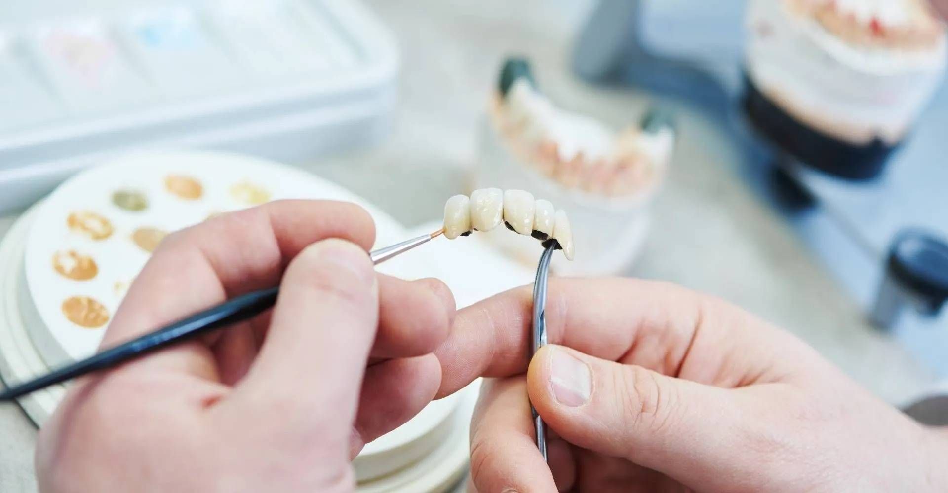 Eine Person trägt in einem Dentallabor mit einem Pinsel Keramik auf eine Brücke aus Zahnkronen auf.