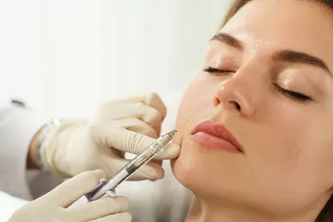 Una mujer recibe una inyección de botox en los labios.