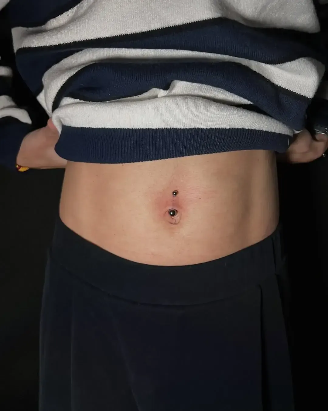 Persona con dos piercings recientes en el ombligo. Fondo oscuro, falda azul marino y suéter a rayas.