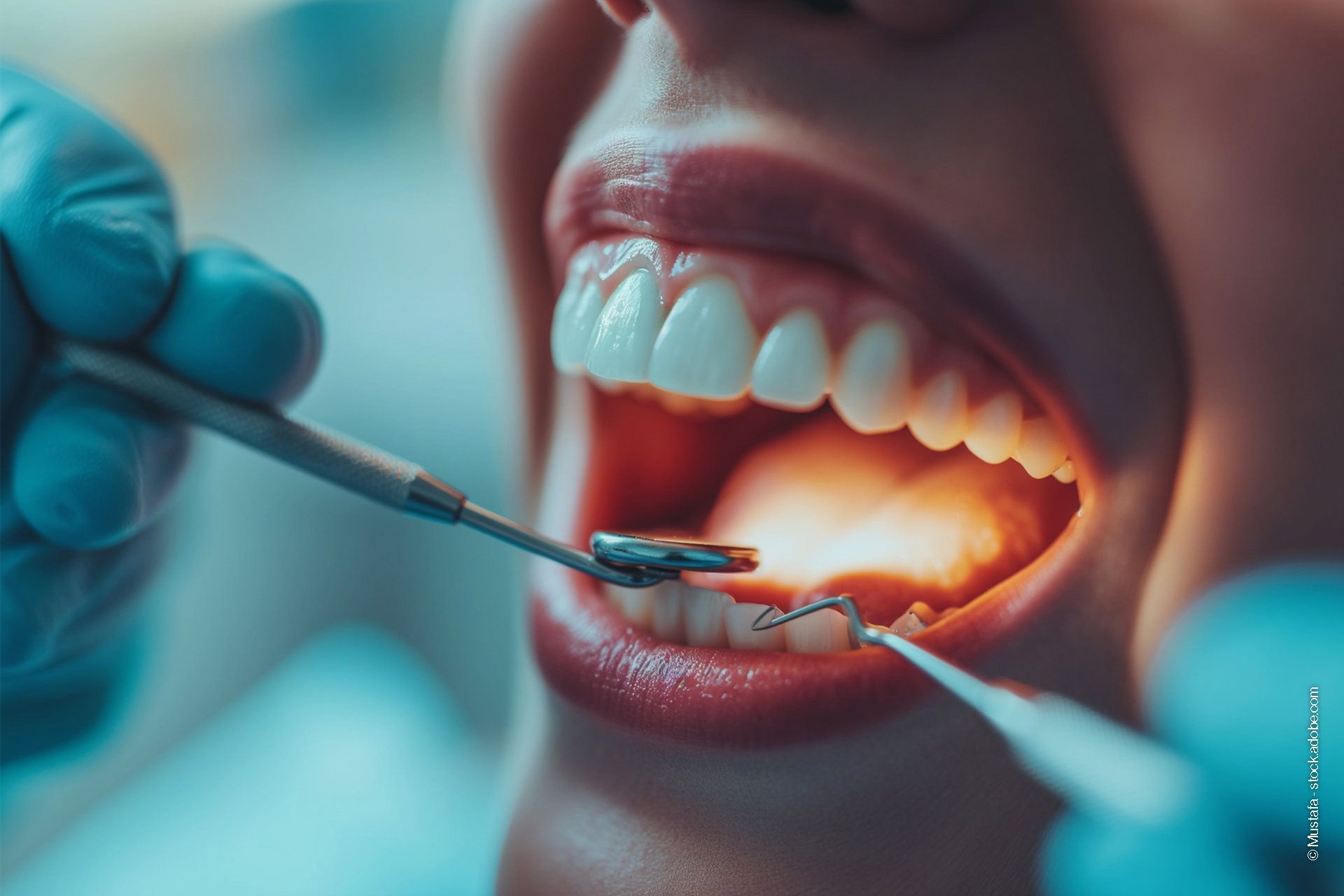 Ein geöffneter Mund einer Frau, in welchem ein Zahnarzt gerade hineinleuchtet, um mehr zu erkennen