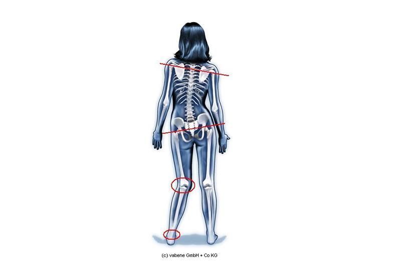 Eine Zeichnung eines Frauenskeletts mit roten Kreisen um ihre Gelenke