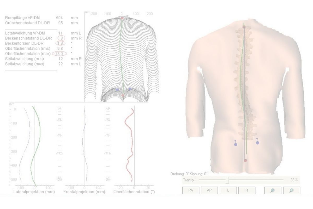 Volker Müller Orthopädie und Schuhtechnik - Grafik zu Gleichgewicht und Bewegung durch Muskelspannung