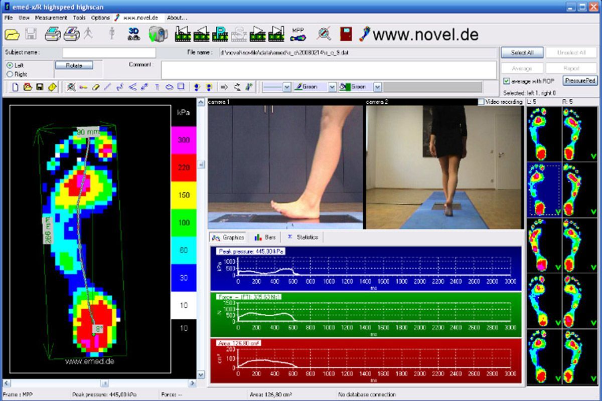 Volker Müller Orthopädie und Schuhtechnik - Screenshot Pedographie