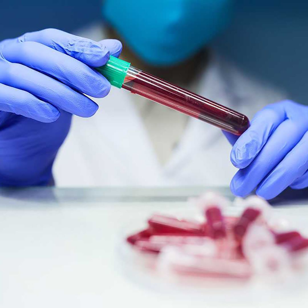 Mani guantate che reggono una provetta per un campione di sangue in un ambiente di laboratorio.