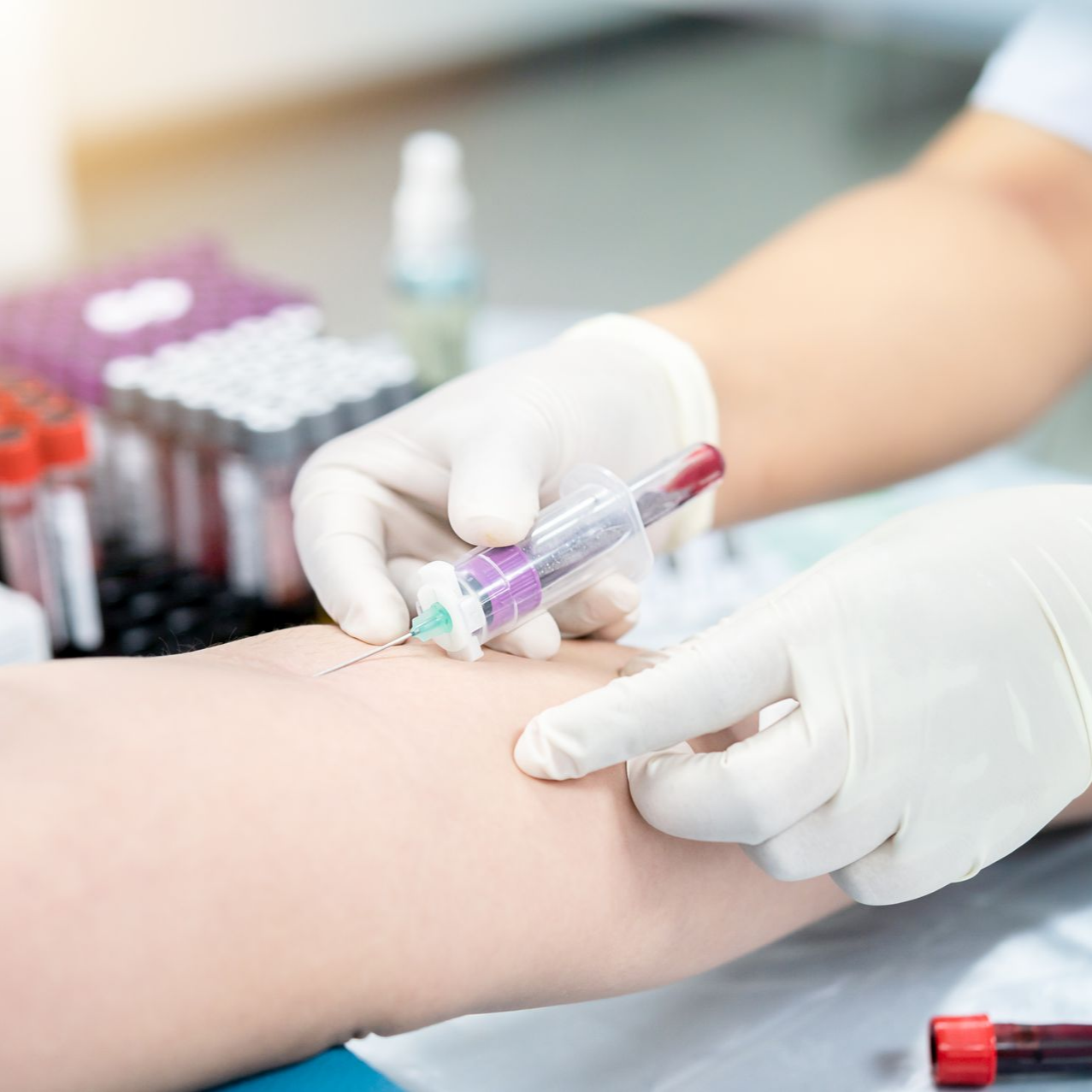 Des mains gantées prélèvent du sang au bras d'un patient à l'aide d'une seringue dans un environnement clinique.