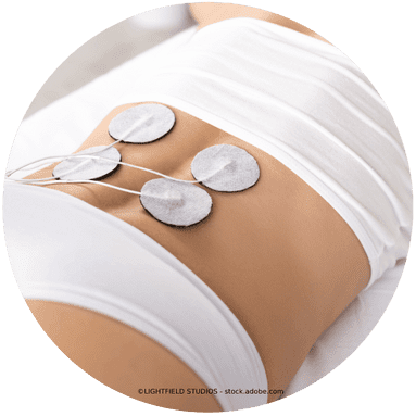 Vier Elektroden auf Bauchmuskulatur