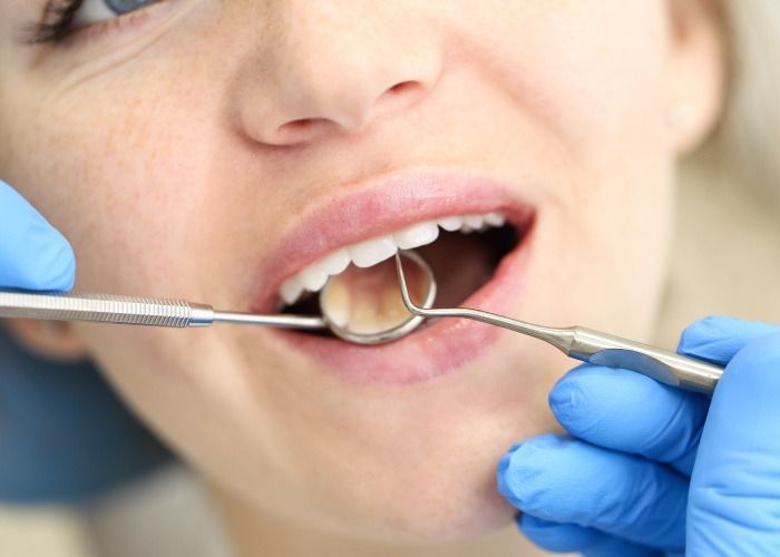 Odontólogo examinando la boca abierta de un paciente con instrumental dental y guantes azules.