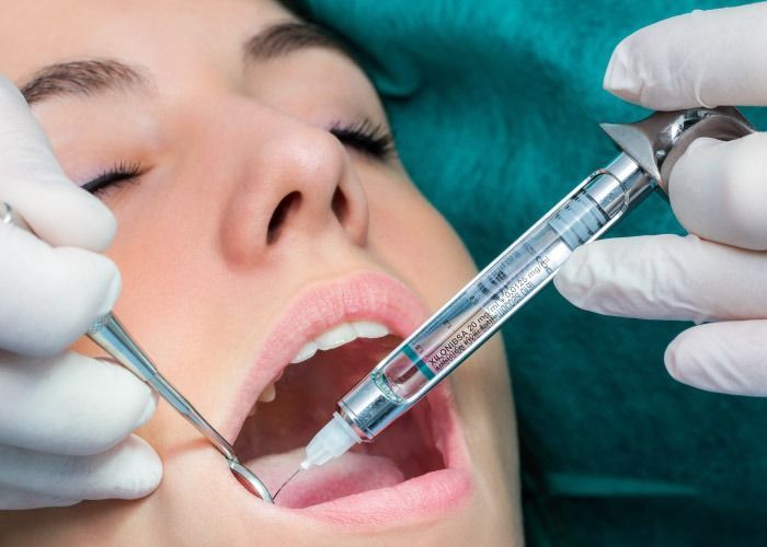 Inyección dental administrada en la boca abierta de un paciente por manos enguantadas en un entorno clínico.