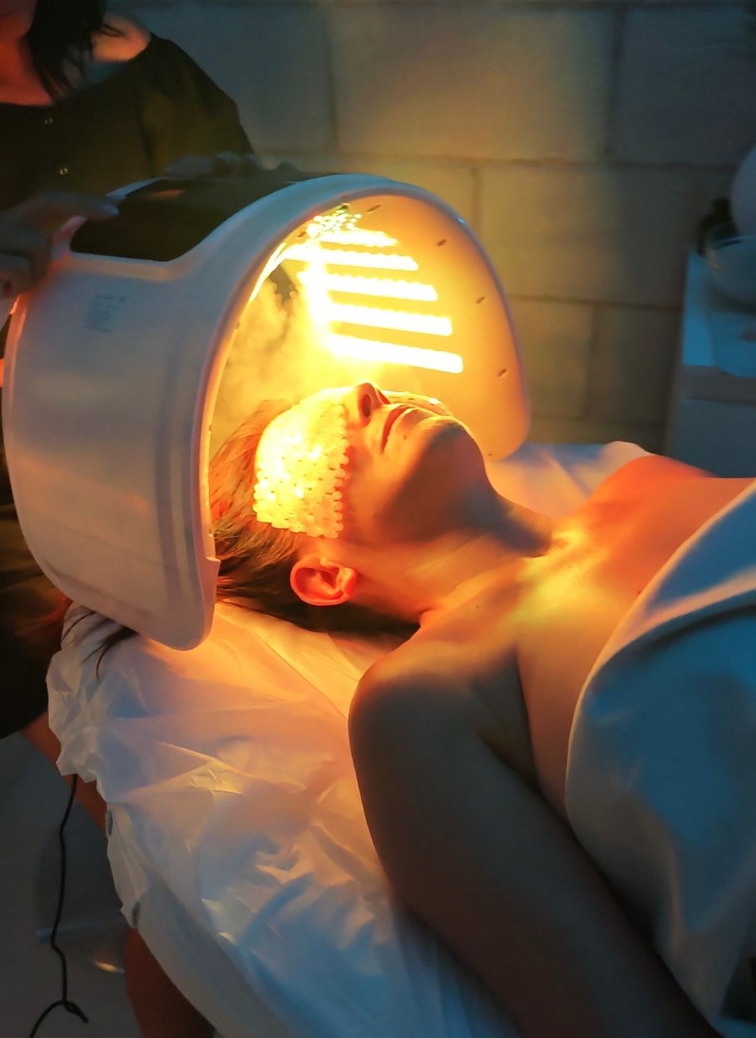 Aplicación de un tratamiento de fotorejuvenecimiento