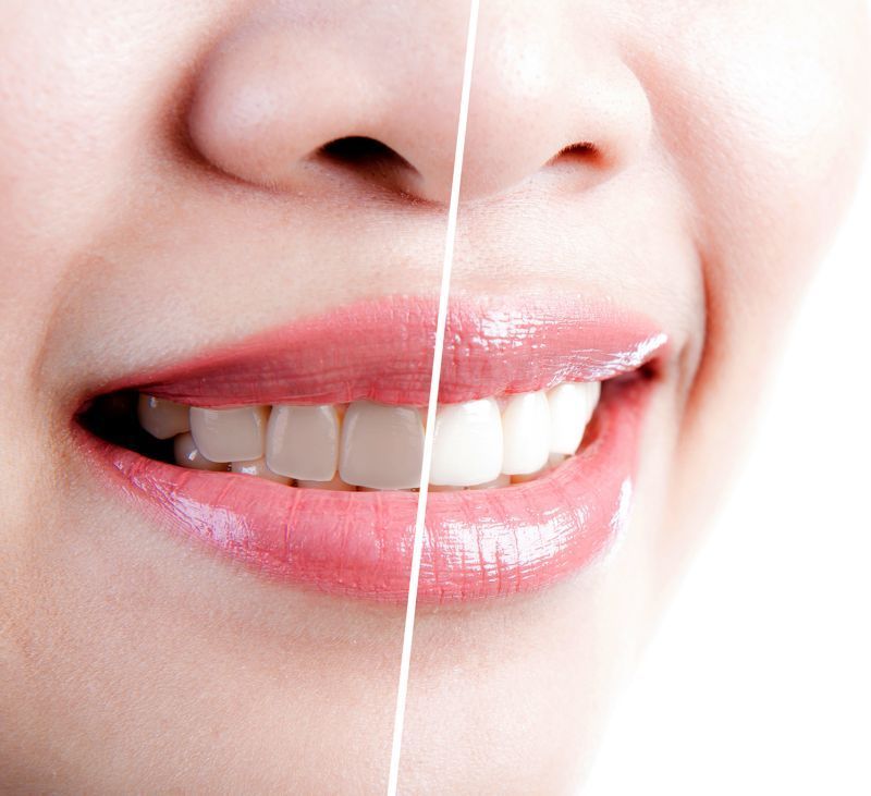 Eine Nahaufnahme des Lächelns einer Frau mit weissen Zähnen.