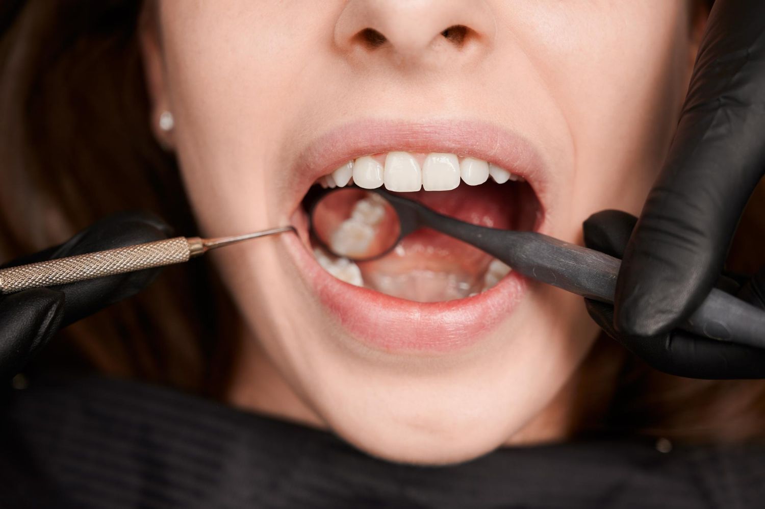 Endodontia Endodontia