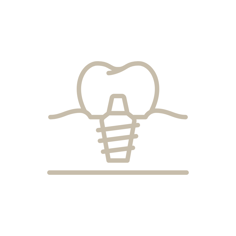 Un dibujo lineal de un diente y un implante dental.