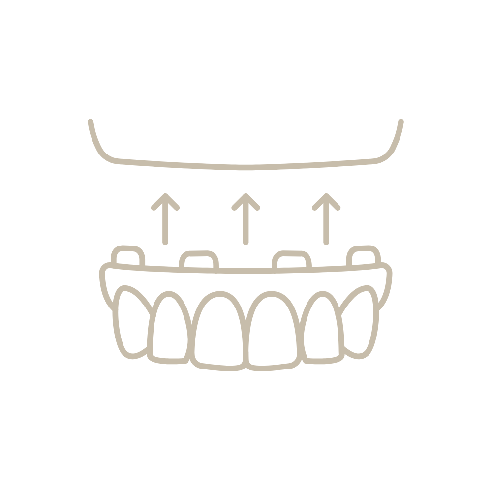 Un dibujo lineal de una dentadura con tres flechas apuntando hacia arriba.