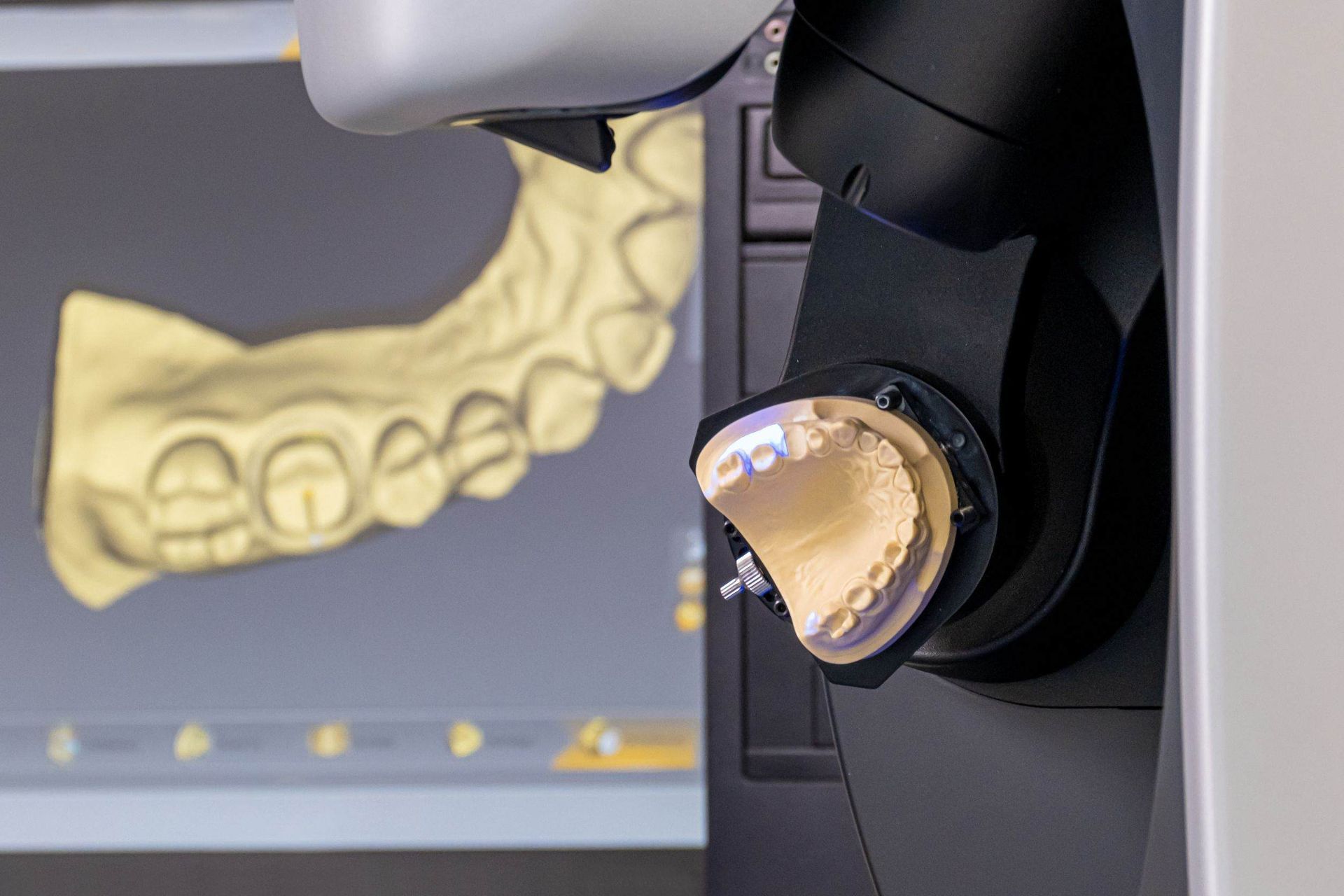 Un primer plano de un escáner dental con un modelo de un diente en el fondo.