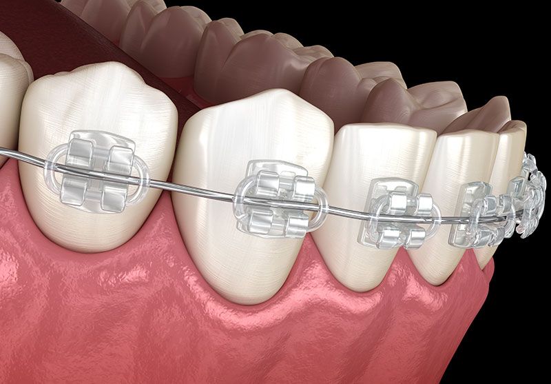 Schwendner & Ihrig GmbH