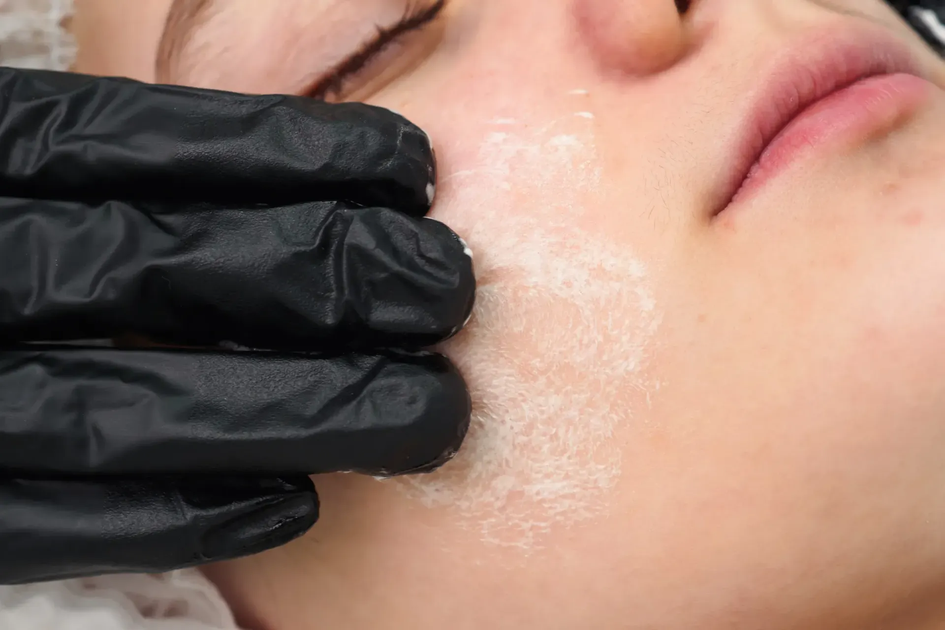 Una mujer está recibiendo un tratamiento facial con guantes negros en la cara.