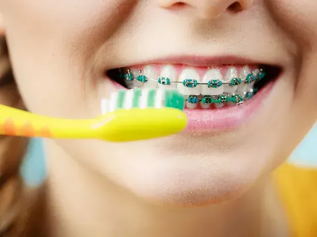 Una mujer con aparatos dentales se cepilla los dientes con un cepillo de dientes amarillo.